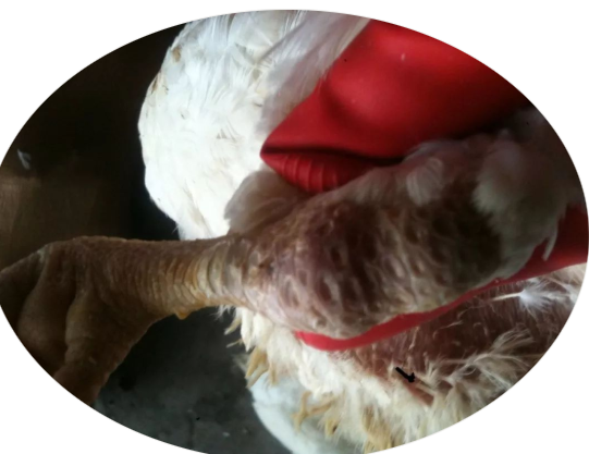 關(guān)節(jié)炎型 關(guān)節(jié)炎型