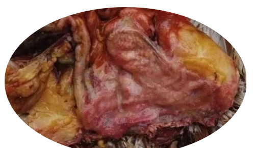 輸卵管炎型 輸卵管炎型