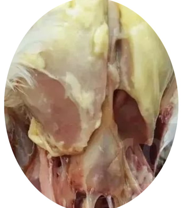 肝周炎型 肝周炎型