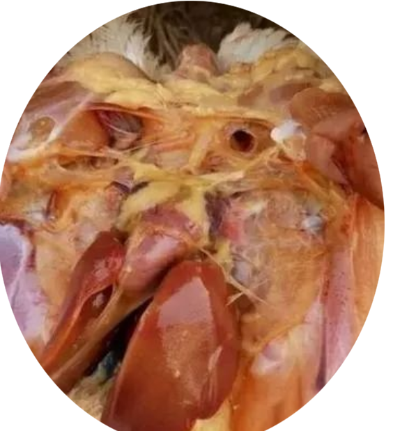 氣囊炎型 氣囊炎型