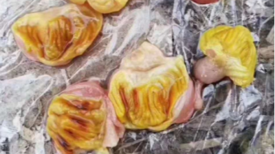雞腺肌胃炎 雞腺肌胃炎